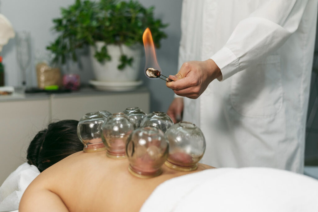 Cupping Therapy in Houston: Muscle Release, Improved Circulation & Faster Recovery Benefits